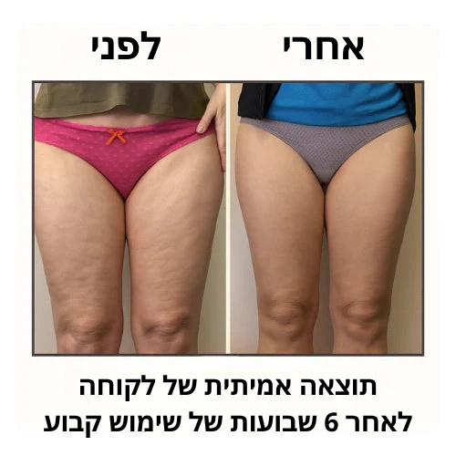 Boonality™ מסאז’ר לימפתי
