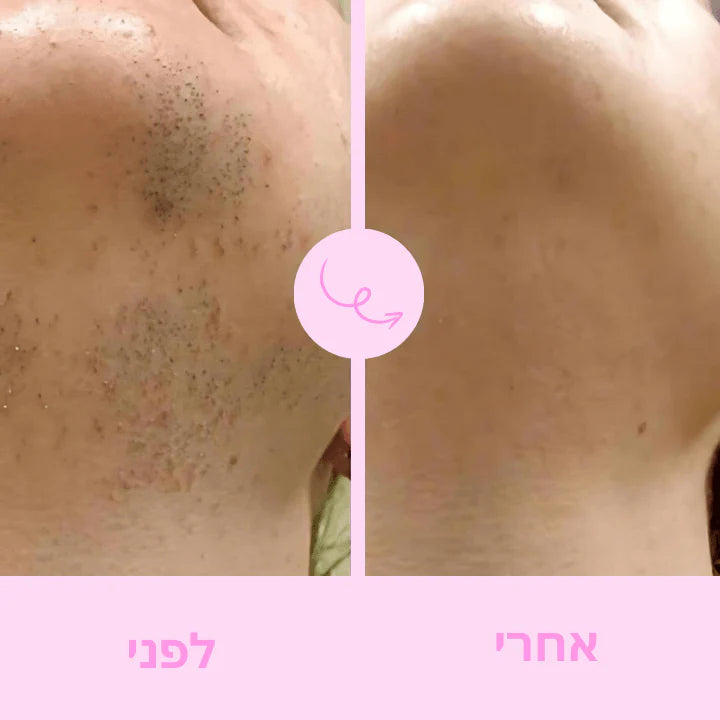 Boonality™ – מכשיר גילוח נשי מהיר ונוח