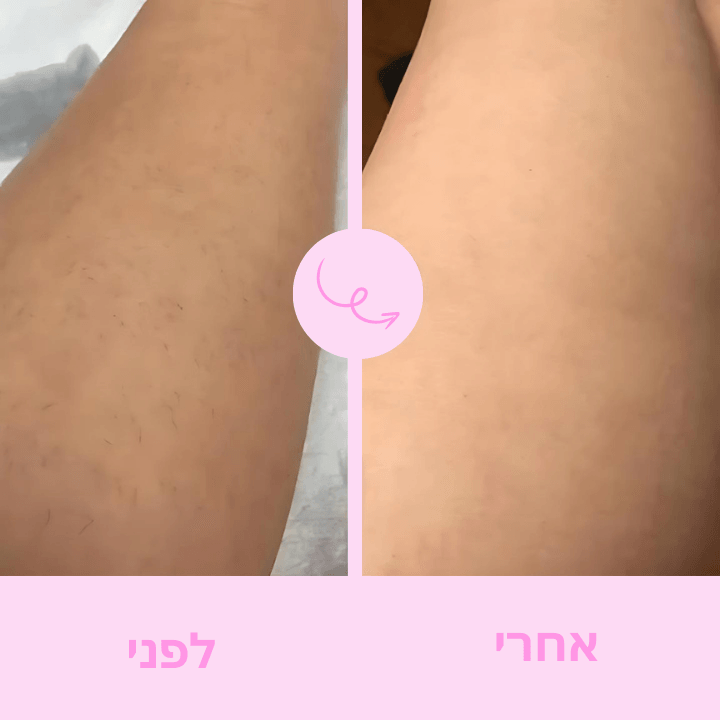 Boonality™ - להסיר שיער בנוחות